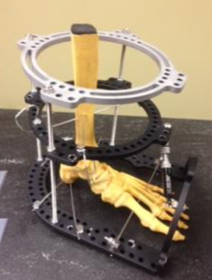 CNC Milling - Concencrict Tool CT